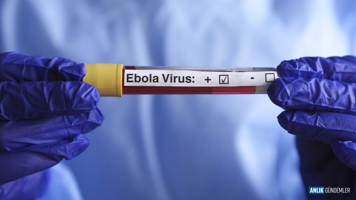 Kongo'da Ebola Kabusu Büyüyor: 7 Bin Vaka, 3 Bin 500 Can Kaybı! Uluslararası Sağlık Örgütü'nden Endişe Veren Rapor